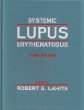 Systemic Lupus Erythematosus