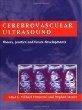 Cerebrovascular Ultrasound: Theory, Practice and Future Developments