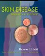 Skin Disease: Diagnosis and Treatment