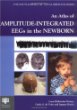 An Atlas of Amplitude-Integrated EEGs in the Newborn